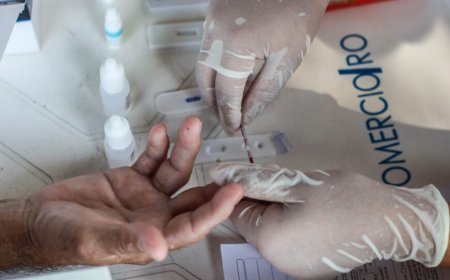 Testes e tratamento antirretroviral são disponibilizados na rede estadual de saúde