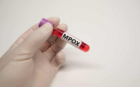 Ministério da Saúde vai instituir comitê de emergência para mpox