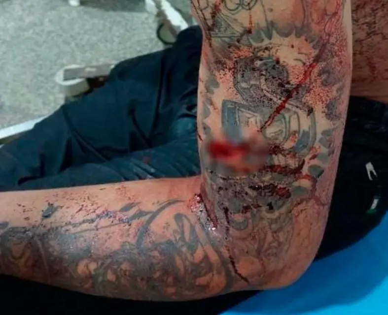 Jovem é atacado a facadas por negar romance em festa na capital