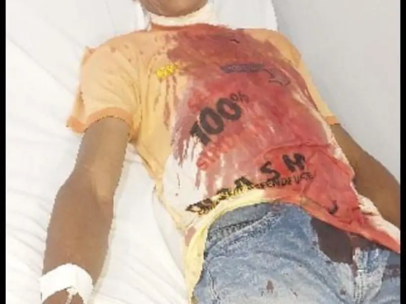 Mais uma vítima do cerol: homem tem pescoço cortado por linha enquanto andava de bicicleta