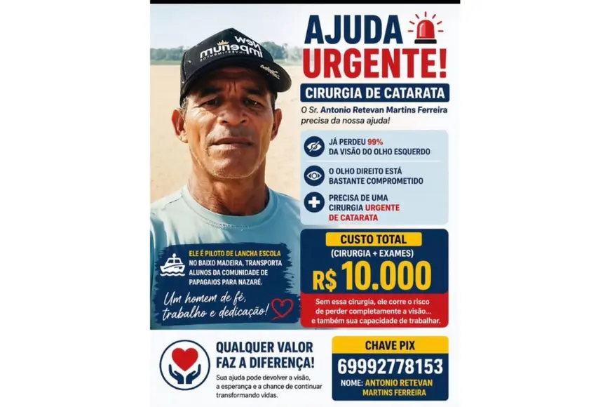 Piloto de lancha do Baixo Madeira precisa de cirurgia de catarata