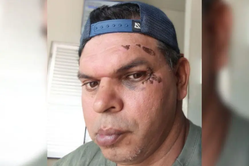 Cadeirante sofre grave queda em buraco na Avenida JK de Ariquemes