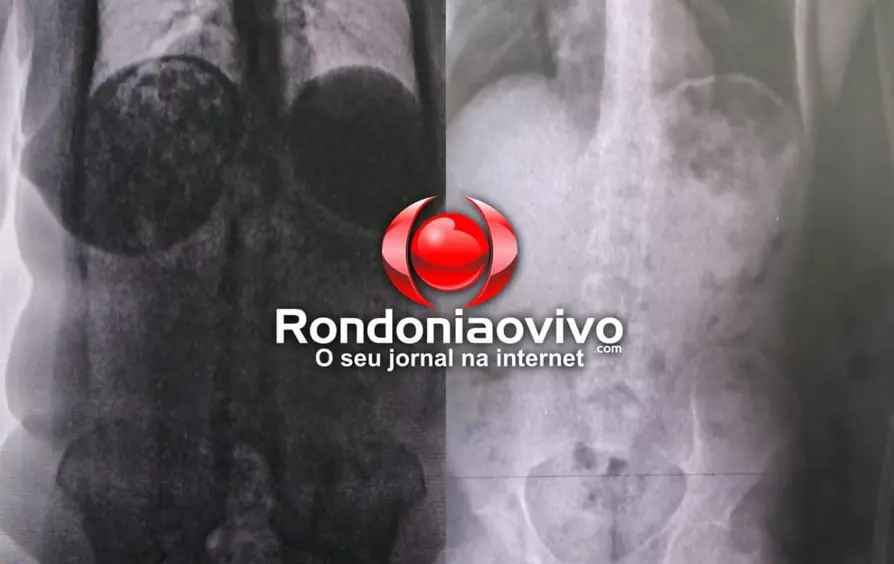 Treze mulheres detidas na Penitenciária 603 por drogas ocultas