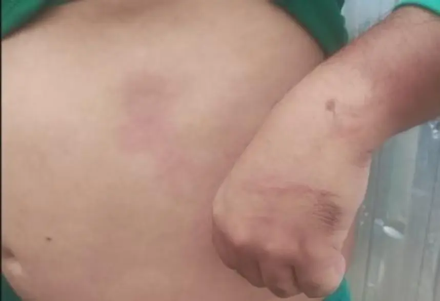 NOVA PROVA anuncia medidas após agressão de PM a trabalhador em Porto Velho